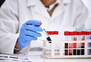 All Blood Tests in Mumbai – Complete Health Check Guide