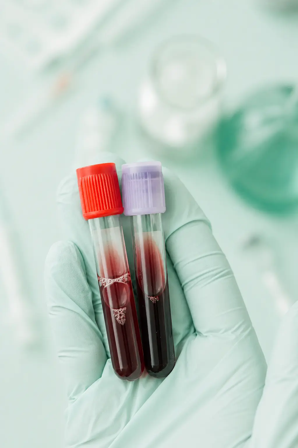 Blood Tests In Mumbai At Naraya Health
